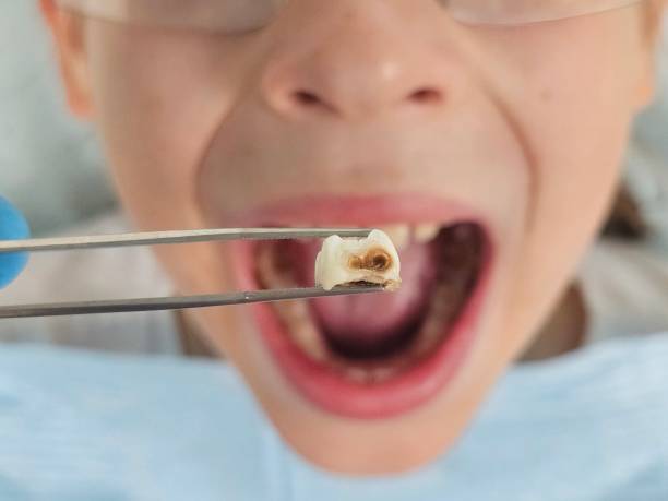 Best Urgent Tooth Repair  in King George, VA